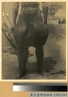 藏品(陰囊象皮病寫真)的圖片